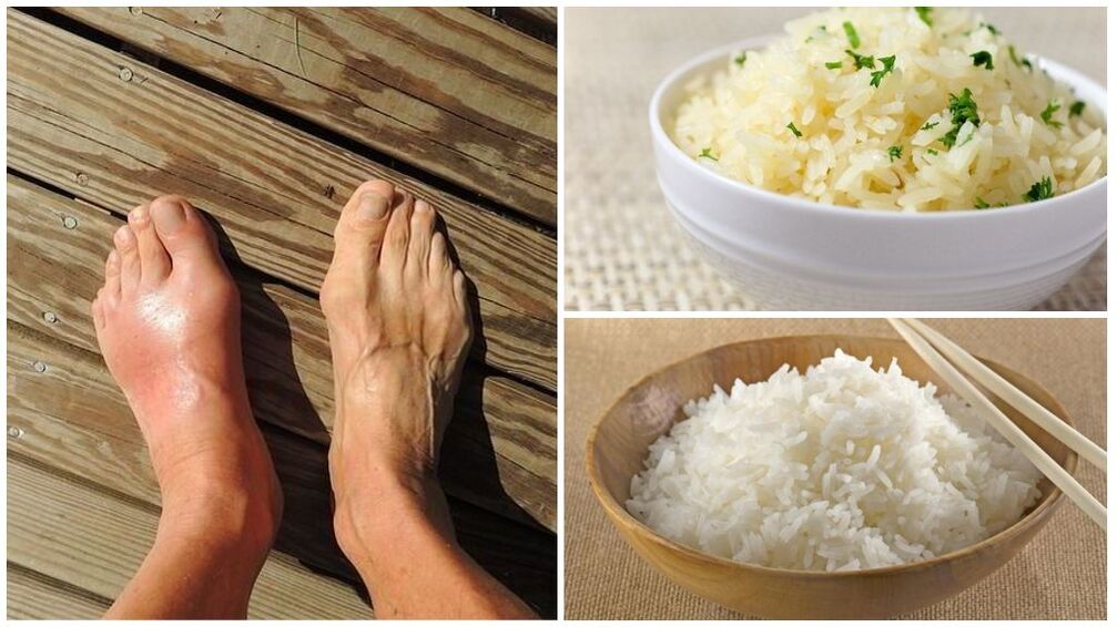 गठिया के रोगियों के लिए चावल आधारित आहार की सलाह दी जाती है।